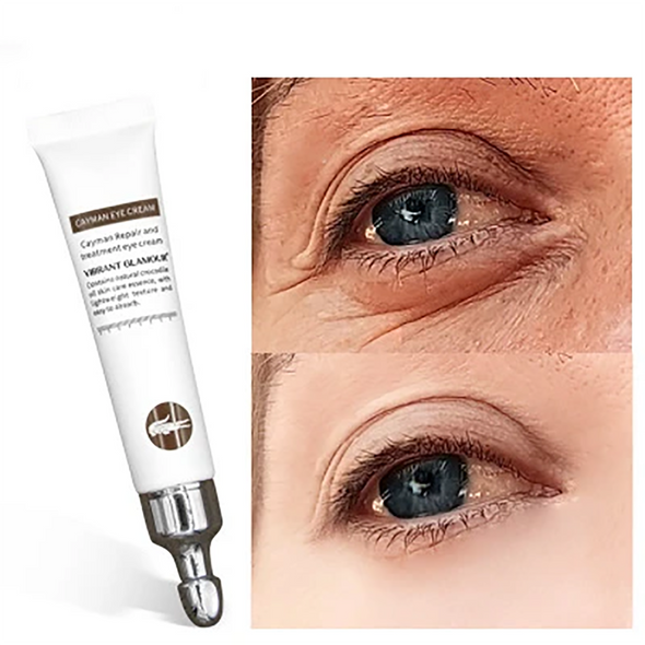 🔥Magic Eye Cream - remove eye bags/dark circles/eye wrinkles