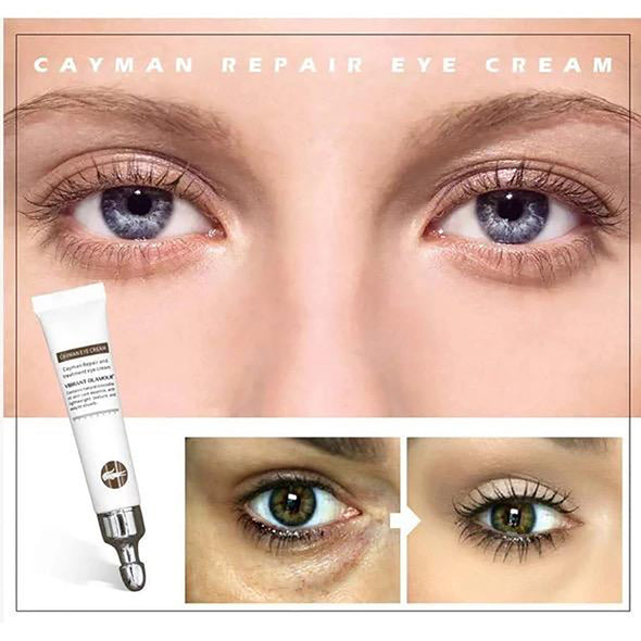 🔥Magic Eye Cream - remove eye bags/dark circles/eye wrinkles